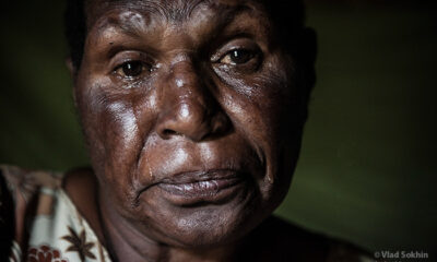 saúde da mulher negra